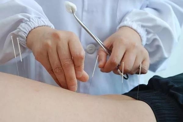 糖尿病中医保健指南：针灸推拿导引
