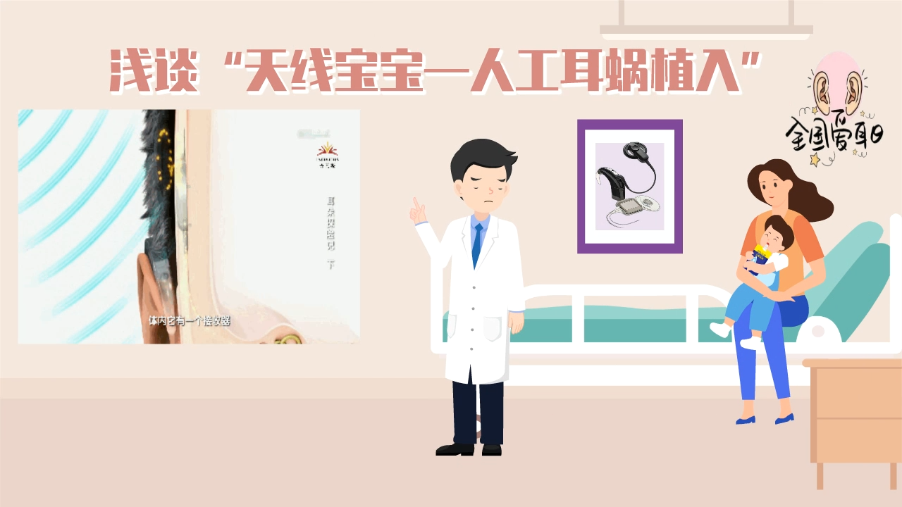 天线宝宝—人工耳蜗植入