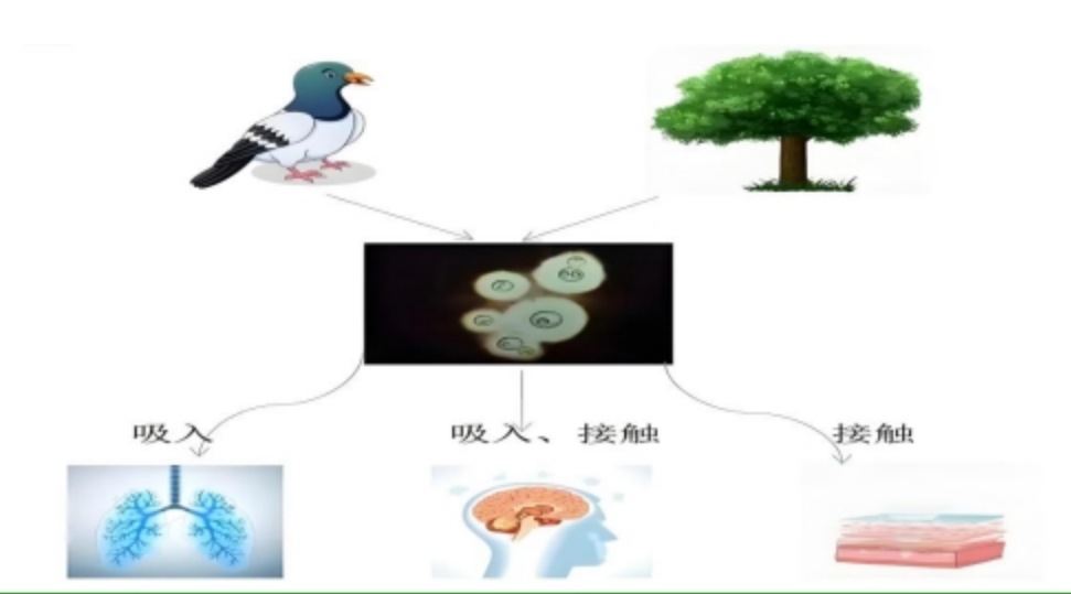 【健康科普】难言之”隐”——隐球菌性脑膜炎 
