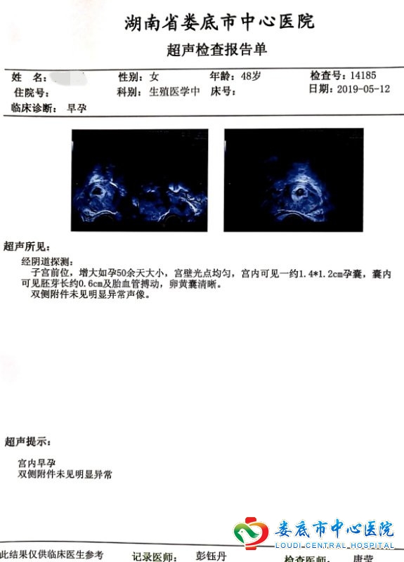 娄底48岁“高龄妈妈”首次试管胚胎移植成功妊娠