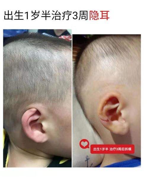 让每一个宝宝都成为幸运儿
